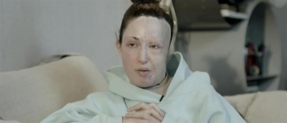 Η Ιωάννα Παλιοσπύρου χωρίς μάσκα: To σημείο “μηδέν” και οι σκέψεις για αυτοκτονία (βίντεο)