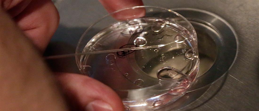 Εξωσωματική γονιμοποίηση: H πρώτη ωοληψία σε ζευγάρι με κορονοϊό