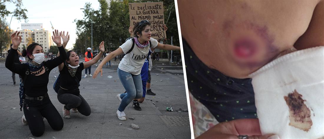 Χιλή: Αστυνομικοί πυροβολούν διαδηλωτές (βίντεο)
