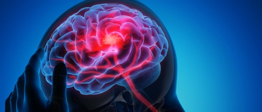 Ενδοαγγειακή Νευροχειρουργική για αντιμετώπιση βλαβών του εγκεφάλου