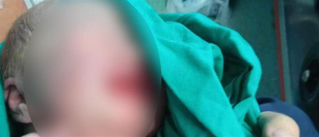 Φωτιά στην Αλεξανδρούπολη - Εκκένωση νοσοκομείου: Έγκυος γέννησε καθοδόν σε ασθενοφόρο (εικόνες)