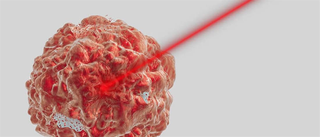 Σύστημα Υβριδικής Απεικόνισης (Fusion Imaging) για την διάγνωση του καρκίνου του προστάτη στην υπερηχογραφικά κατευθυνόμενη βιοψία