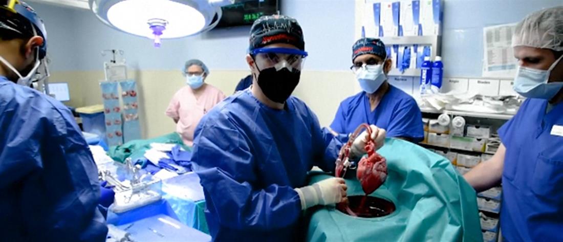 Μεταμόσχευση καρδιάς χοίρου σε άνθρωπο για πρώτη φορά! (βίντεο)