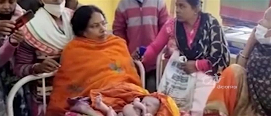 Ινδία: μωρό γεννήθηκε με τέσσερα χέρια και τέσσερα πόδια (βίντεο)